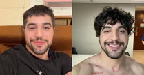 Nattan conta que se arrependeu de raspar a cabeça: 'O bonito era o cabelo, não eu'