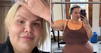 O que Thais Carla tem? Especialista explica diagnóstico após dançarina fazer a bariátrica