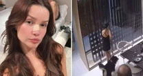 Juliette é empurrada em casa e sofre acidente doméstico: 'Quase quebrei o resto do nariz'