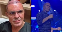 Eduardo Costa faz show careca: 'Não estou preocupado com minha aparência'