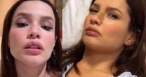 Grave? Especialista opina sobre fratura de Juliette: 'Pode levar a necrose'