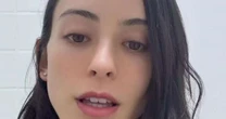 Bella Longuinho confirma término após agressão do namorado: 'Ninguém merece passar por isso'