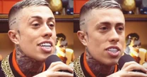 MC Daniel faz procedimentos no rosto e espanta os seguidores: 'Terá problema facial'; veja