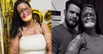LUTO! Influenciadora morre aos 31 anos após batalha contra doença rara