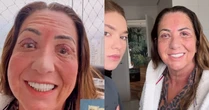 Mãe de Virginia faz cirurgia nos olhos e influenciadora choca web ao mostrar pele retirada: 'Nojo'