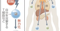 免疫学に革命的進歩　暴走抑える「制御性T細胞」とは　ノーベル生理学・医学賞で話題