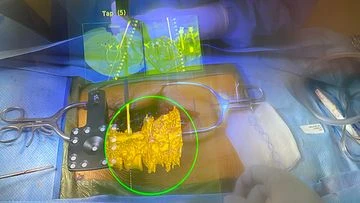 New device gives doctors 'superpowers' during complicated surgeries