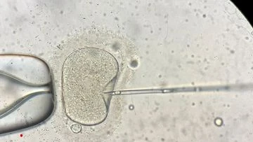 Monash IVF CEO resigns after second embryo bungle
