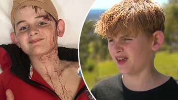 Boy, 12, 'traumatised and scared' by brutal kangaroo attack