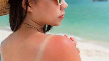 Half of Australians are not using adequate sun protection