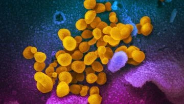 Study of Australian COVID-19 cases reveals long-term health impacts of virus