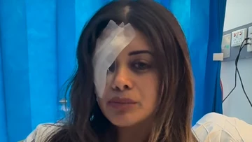 Former Greens candidate injured in protest to fight charges against NSW Police