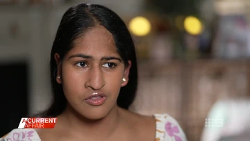 Conjoined twins separated 16 years ago living 'wonderful' lives