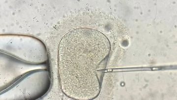 Aussie IVF giant admits to another embryo bungle