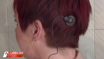 The implant giving hope to Aussies with epilepsy