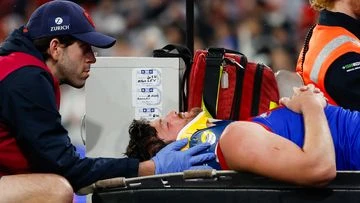 Demons star Angus Brayshaw forced into retirement after brain scan