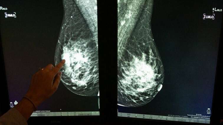 Breast cancer: why it’s difficult to treat, new approaches on horizon