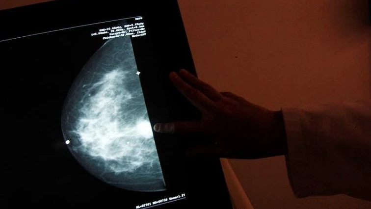 50% drop in number of women screening for breast cancer