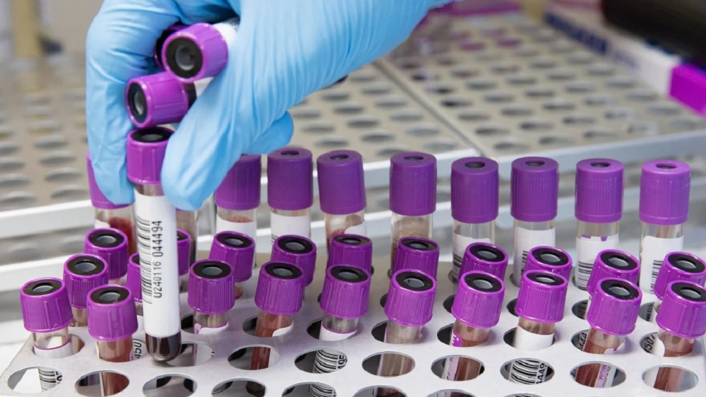 KZN launches mass cervical cancer screening drive amid rising cases