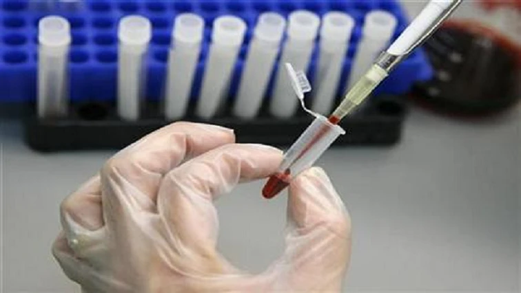 HIV, TB services interruption could see massive deaths due to COVID-19 in Sub-Saharan Africa : UNAIDS