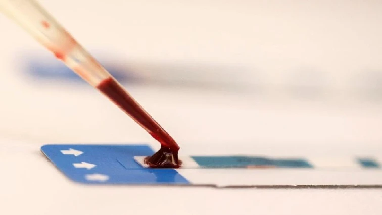 WRHI to fast-track further studies, licencing of injectable antiretroviral