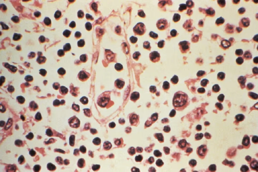 SA working with WHO to trace hantavirus cases locally