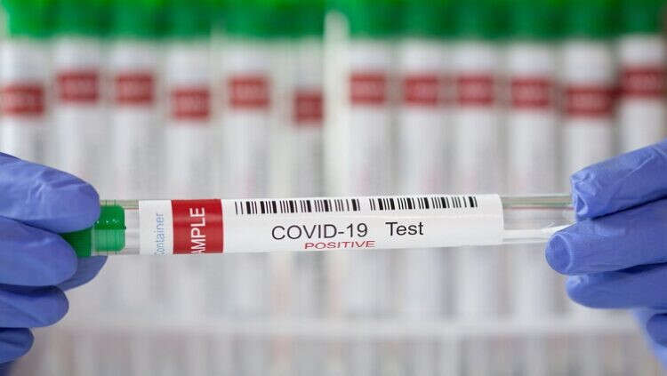 SA labs deny excessive pricing of COVID-19 PCR tests during pandemic