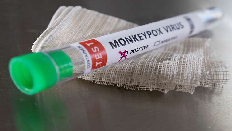 Monkeypox vaccine is available: Dr Coetzee