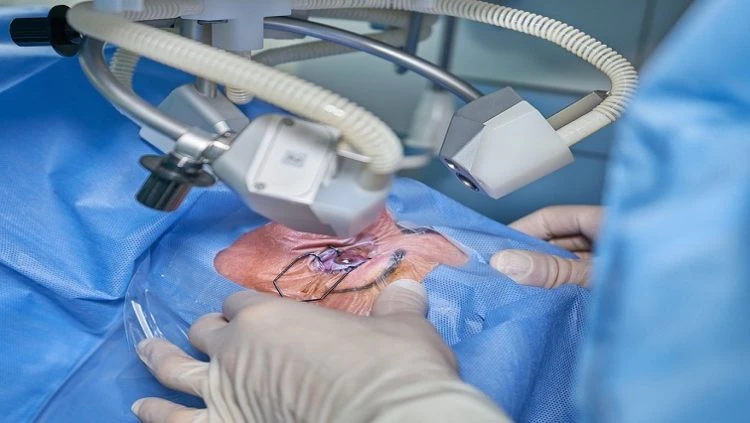 GP launches cataract surgery marathon to restore patients’ sight