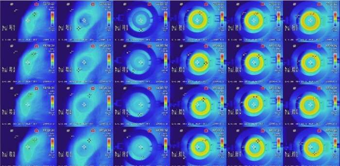 Lenti anti-glaucoma wireless, per diagnosi e terapia