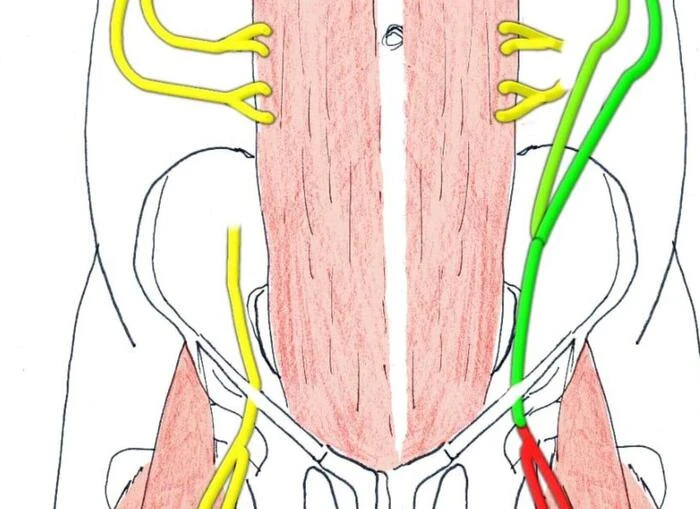 Trasferiti nervi, bimbo di 2 anni verso il recupero della gamba