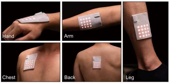 Pronta la pelle elettronica per abbracciarsi via Internet