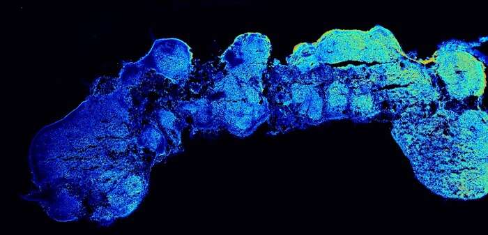 Nuovo modello 3D per studiare il cervello, l'organoide oblungo