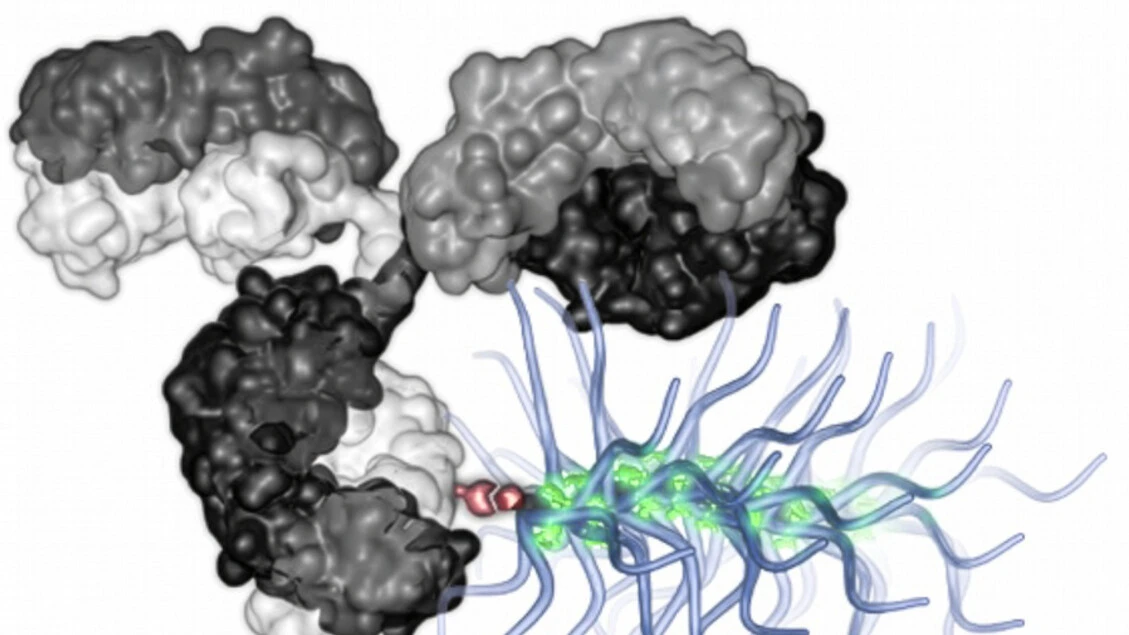 Nuove armi anticancro da nanoparticelle insolite