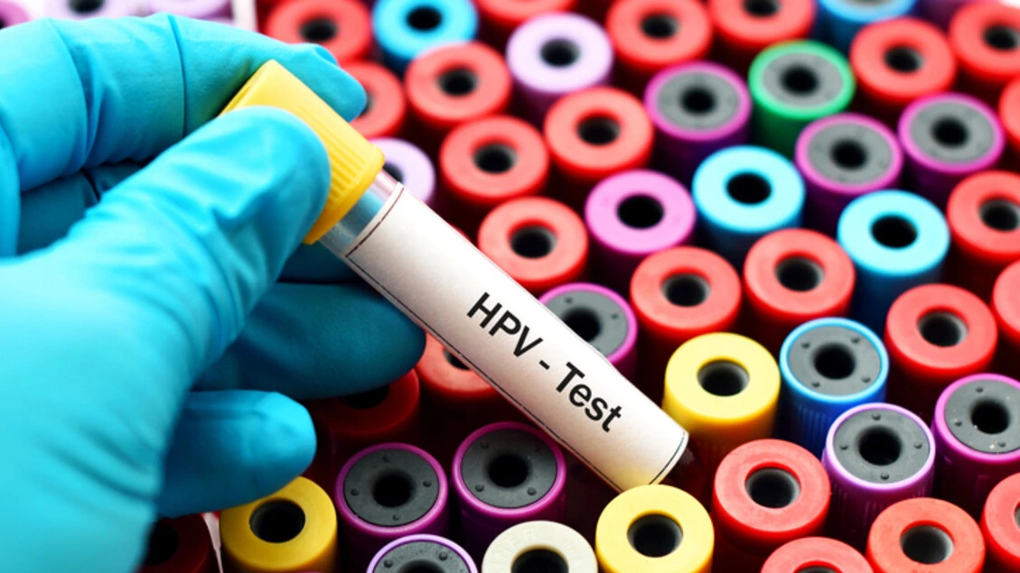 A causa dell'Hpv i tumori testa-collo colpiscono sempre prima