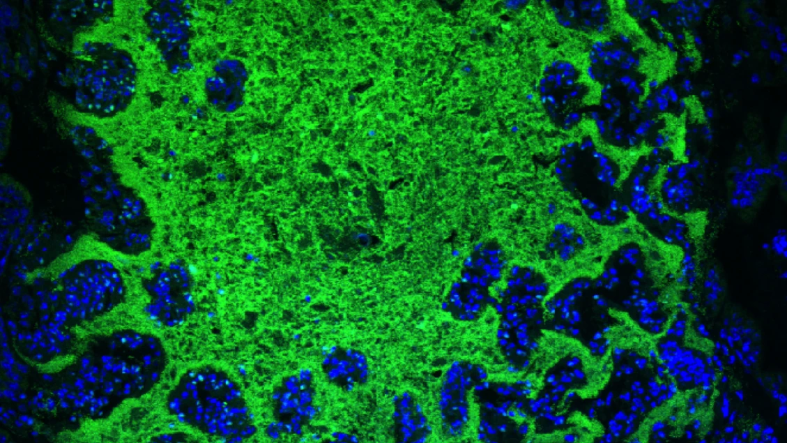 Le diete yo-yo alterano per molto tempo i batteri dell'intestino