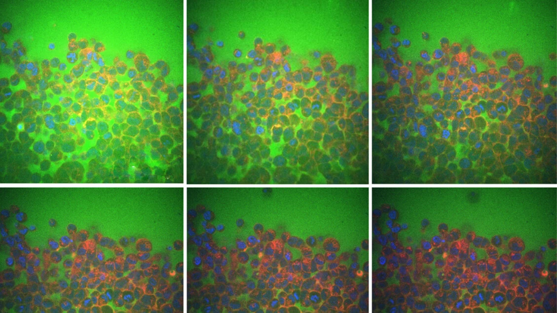 L'elasticità dei tessuti dipende dall'acqua fra le cellule