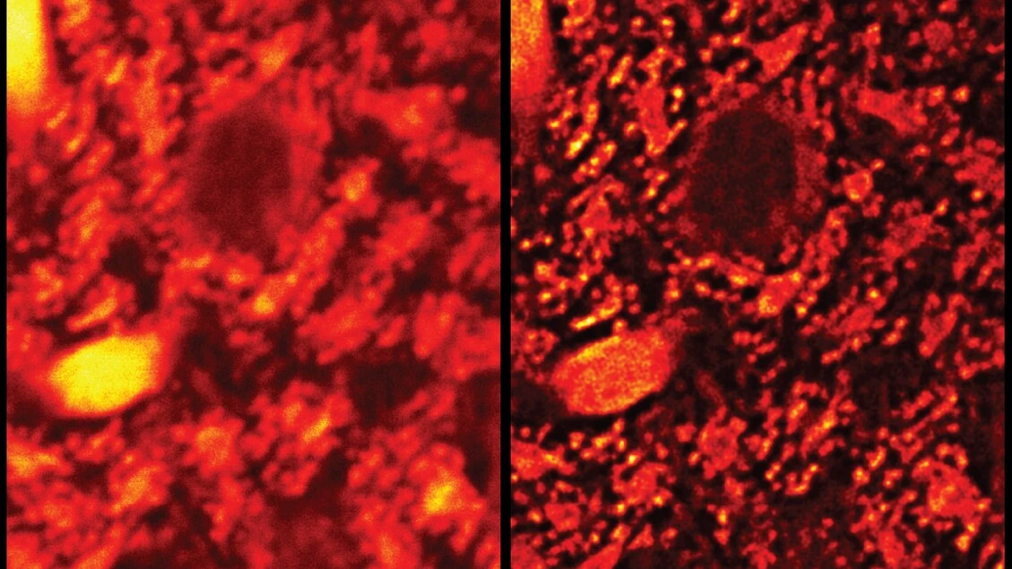 Cellule in super-HD grazie a un bisturi di luce