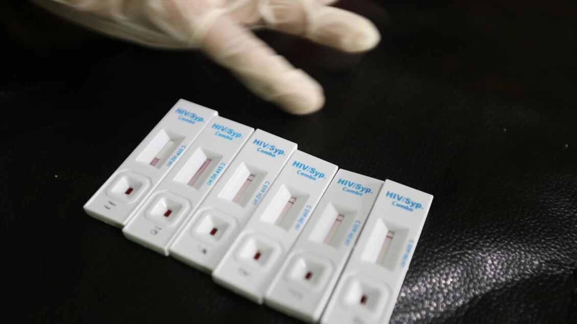 Dermatologi, 'dalla pelle i primi segni del contagio da Hiv'