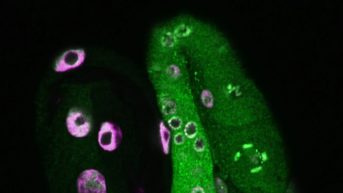 La longevità può essere ereditata, grazie a una proteina