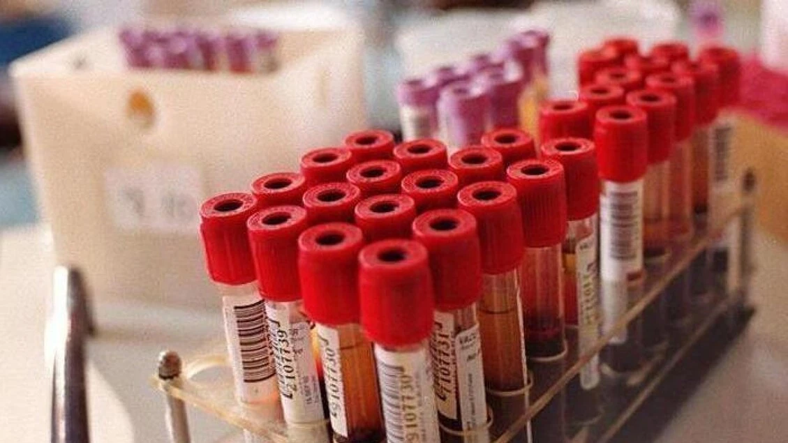 Piemonte, in due mesi 700 preadesioni e 456 prelievi per Pfas