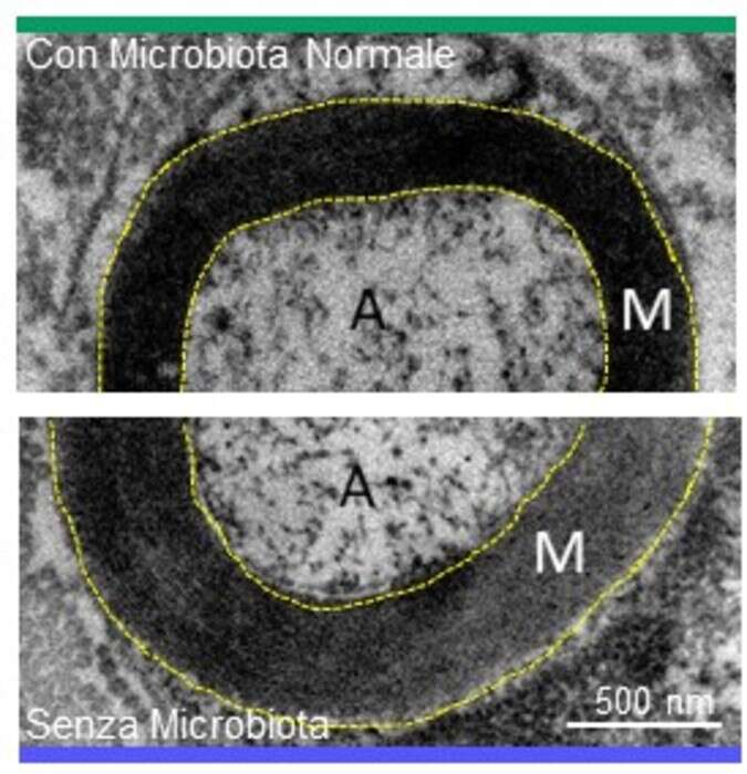 Dimostrato il legame diretto tra intestino, nervi e muscoli