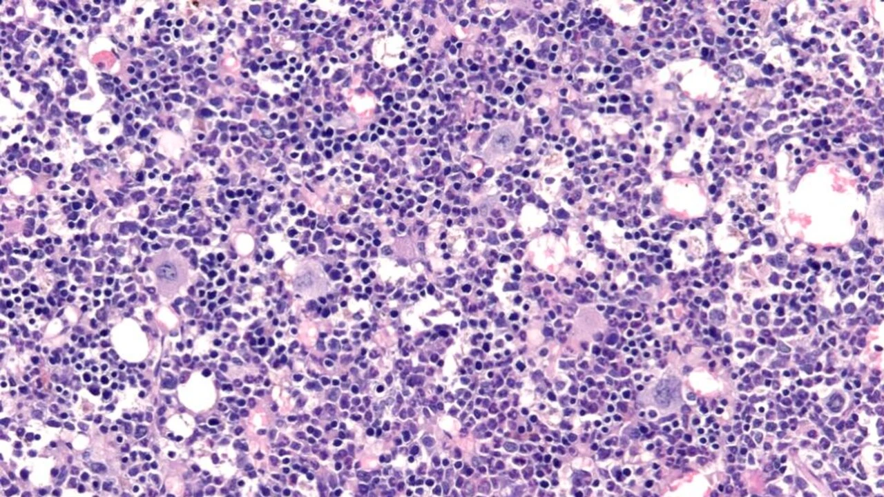 Spento l'allarme che fa invecchiare le cellule del sangue