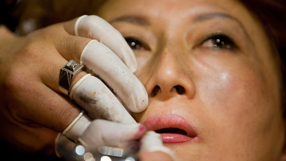 Medici estetici, attenzione ai non-dottori e ai prezzi stracciati