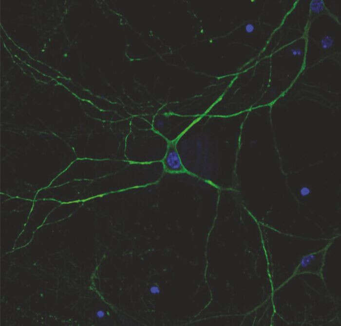 Arriva dalle lucciole un nuovo trattamento per l’epilessia