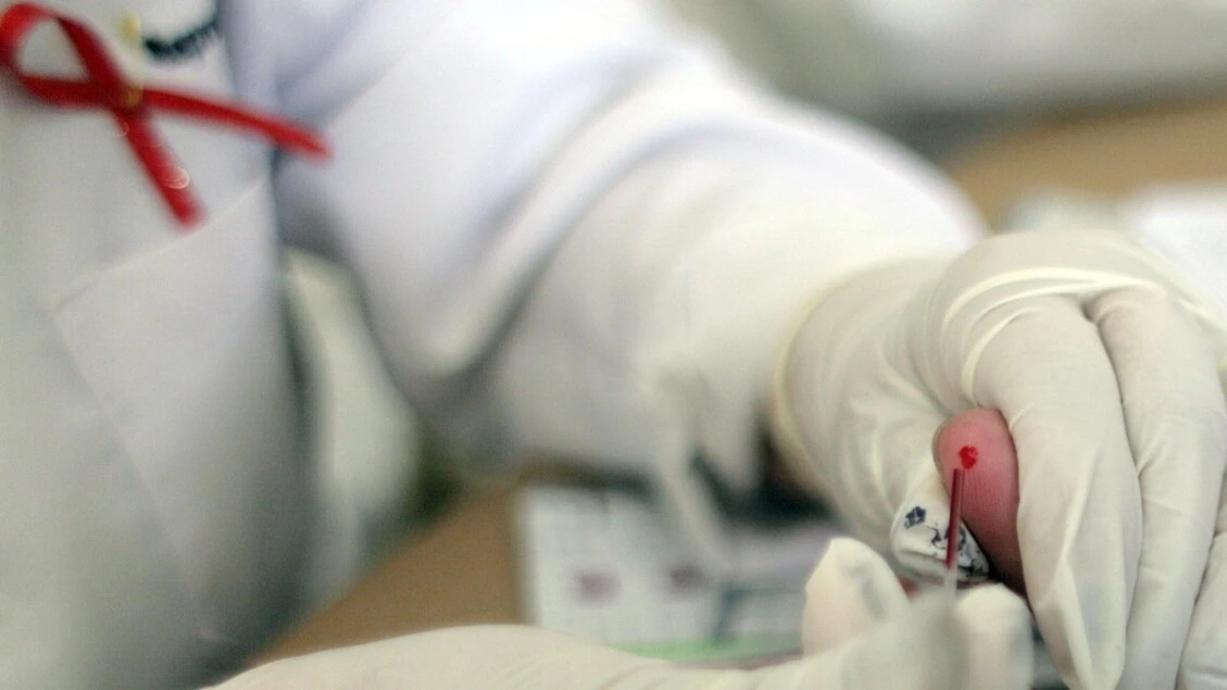 Hiv, primo via libera in Ue a farmaco che protegge dal contagio per 6 mesi