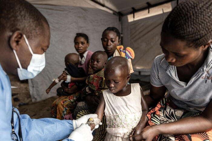 Congo, con aumento malnutrizione 4,5 milioni bimbi rischio Mpox