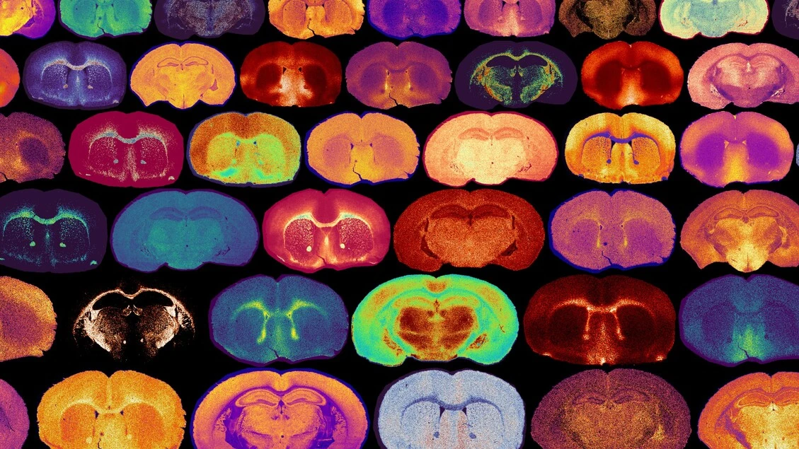 Lo zucchero 2 volte amico del cervello, è carburante e segnale chiave