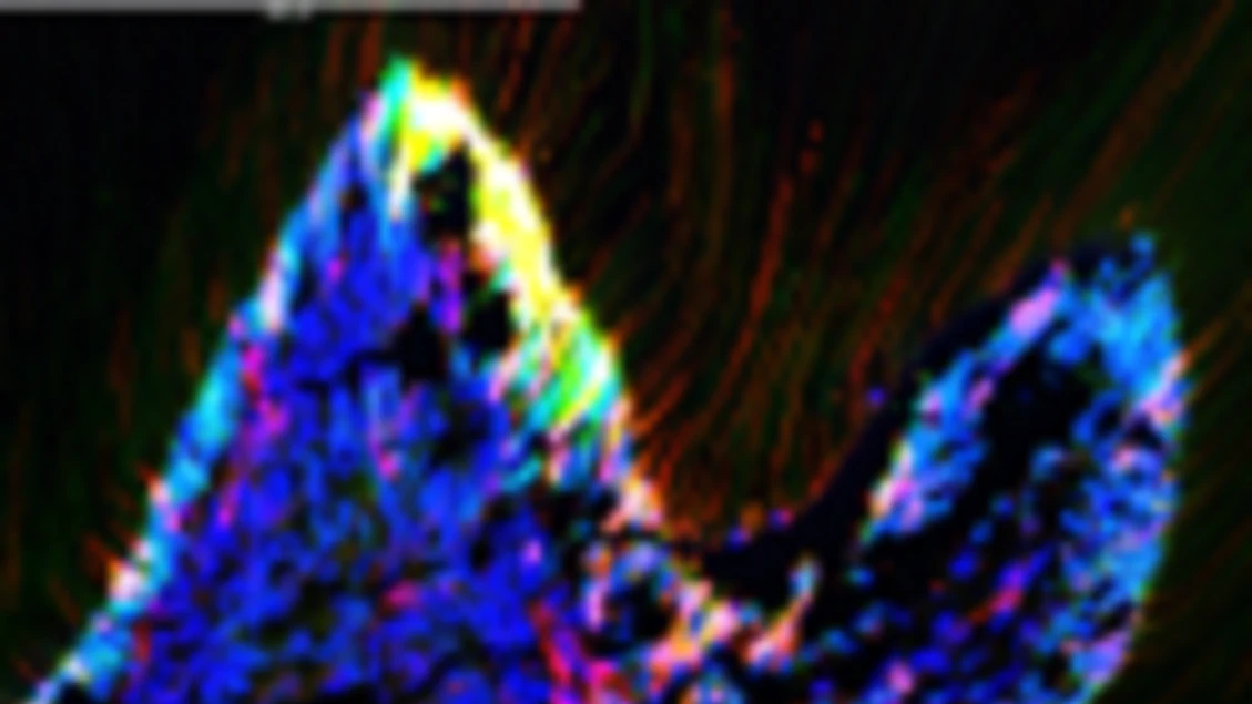 Nelle cellule staminali l'arma contro l'invecchiamento dei denti