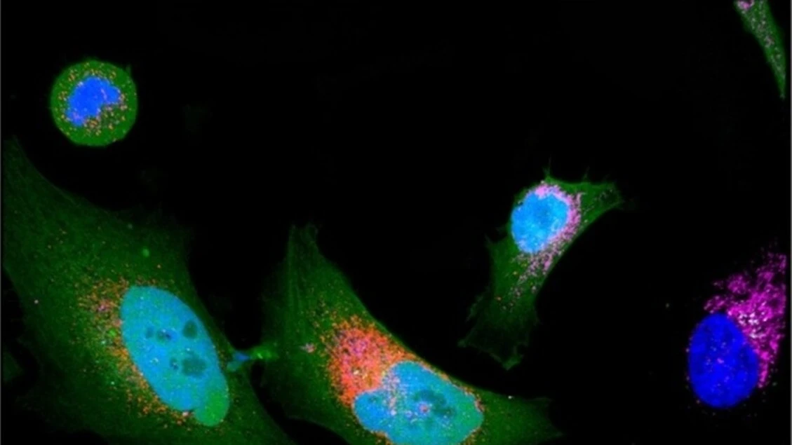 Oltre 1.700 nuove proteine nascoste nel 'proteoma oscuro'